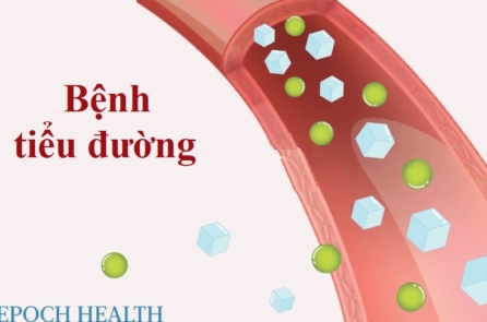 Bệnh tiểu đường: Dấu hiệu sớm, nguyên nhân, điều trị, và giải pháp tự nhiên