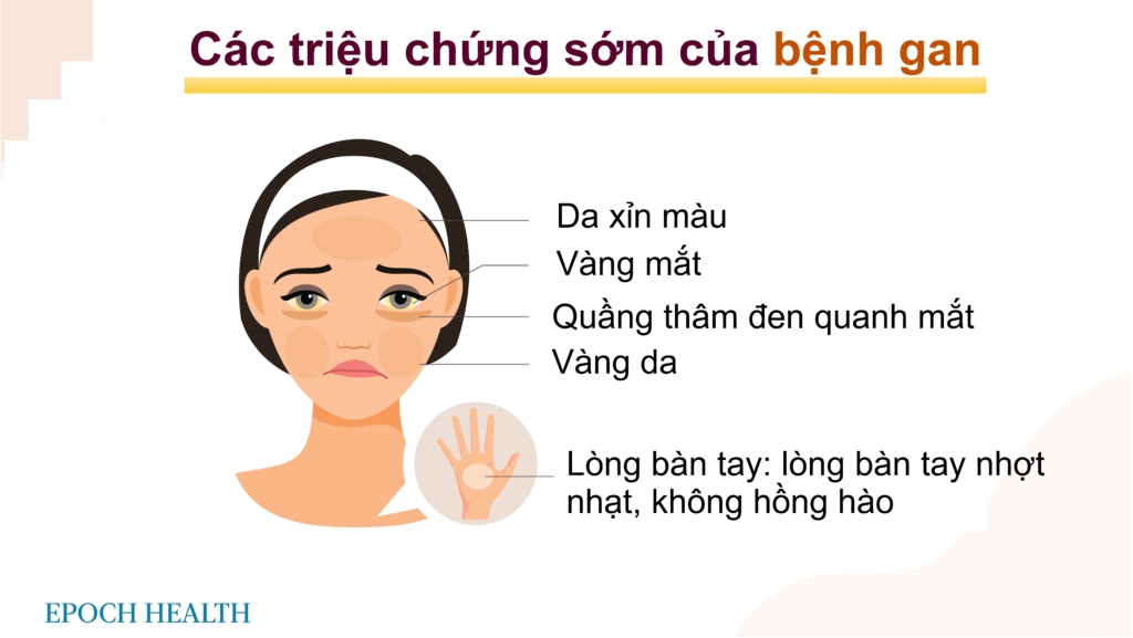 Nhận biết các dấu hiệu về suy gan: Lời khuyên bảo vệ gan vào mùa xuân