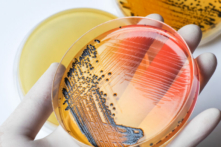 Vi khuẩn Salmonella có lẽ là nguyên nhân phổ biến nhất gây ngộ độc thực phẩm. (Shutterstock)