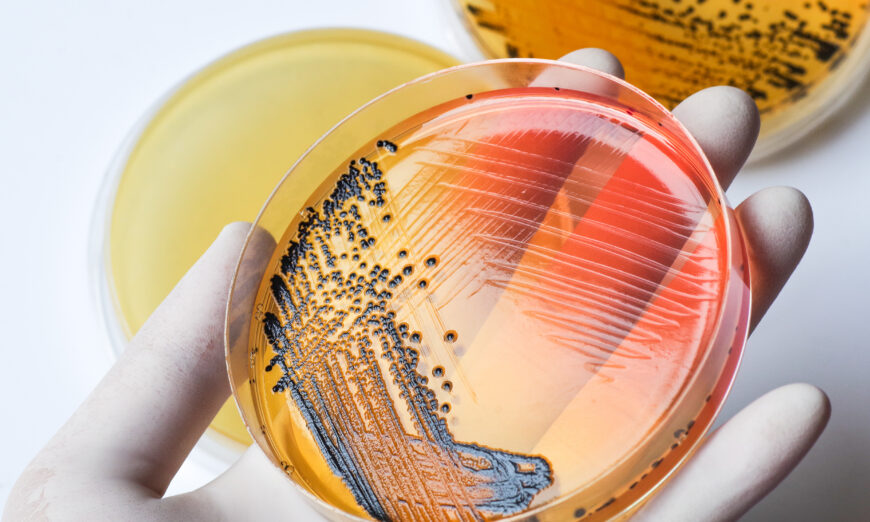 Vi khuẩn Salmonella: Từ kháng thuốc đến kháng thuốc toàn diện
