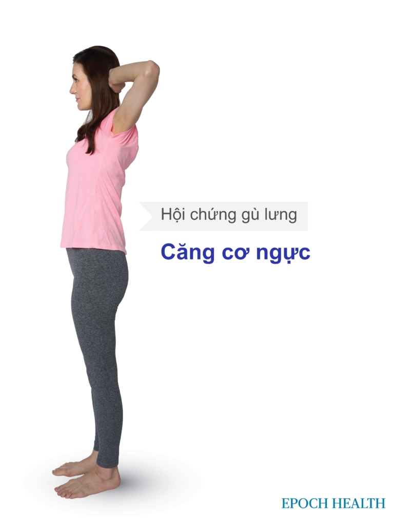 Thói quen ngồi xấu gây gù lưng, 3 bí quyết sửa đơn giản