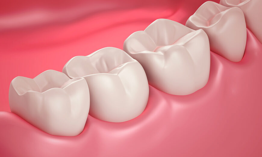Mất răng và tiểu đường có liên quan đến mất trí nhớ