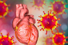 Mặc dù virus SARS-CoV-2 được tìm thấy trong mô tim nhưng virus này lại không gây ra viêm đáng kể. Nguyên nhân mới duy nhất được chứng minh gây tổn thương tim ở người chính là vaccine COVID-19. (Ảnh: Kateryna Kon/Shutterstock)