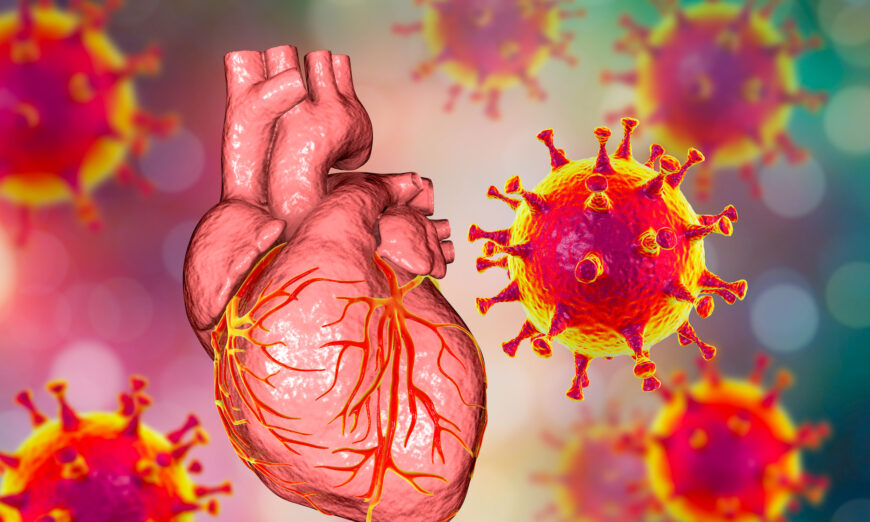 Mặc dù virus SARS-CoV-2 được tìm thấy trong mô tim nhưng virus này lại không gây ra viêm đáng kể. Nguyên nhân mới duy nhất được chứng minh gây tổn thương tim ở người chính là vaccine COVID-19. (Ảnh: Kateryna Kon/Shutterstock)