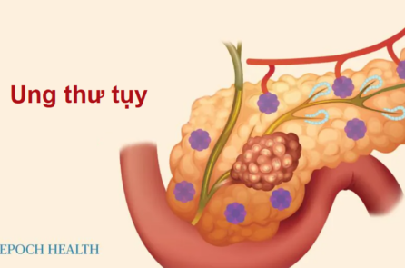 Hướng dẫn cơ bản về ung thư tụy: Triệu chứng, nguyên nhân, phương pháp điều trị và phương pháp tự nhiên