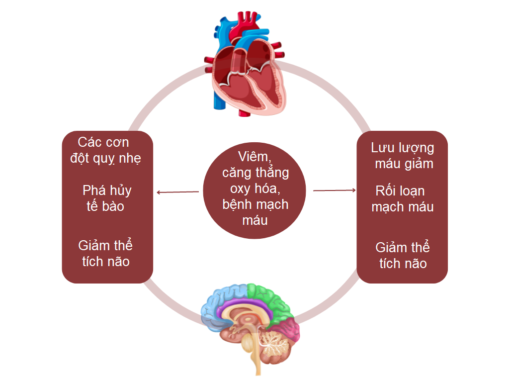 Các nghiên cứu cho thấy một dạng rối loạn nhịp tim phổ biến có thể dẫn đến mất trí nhớ