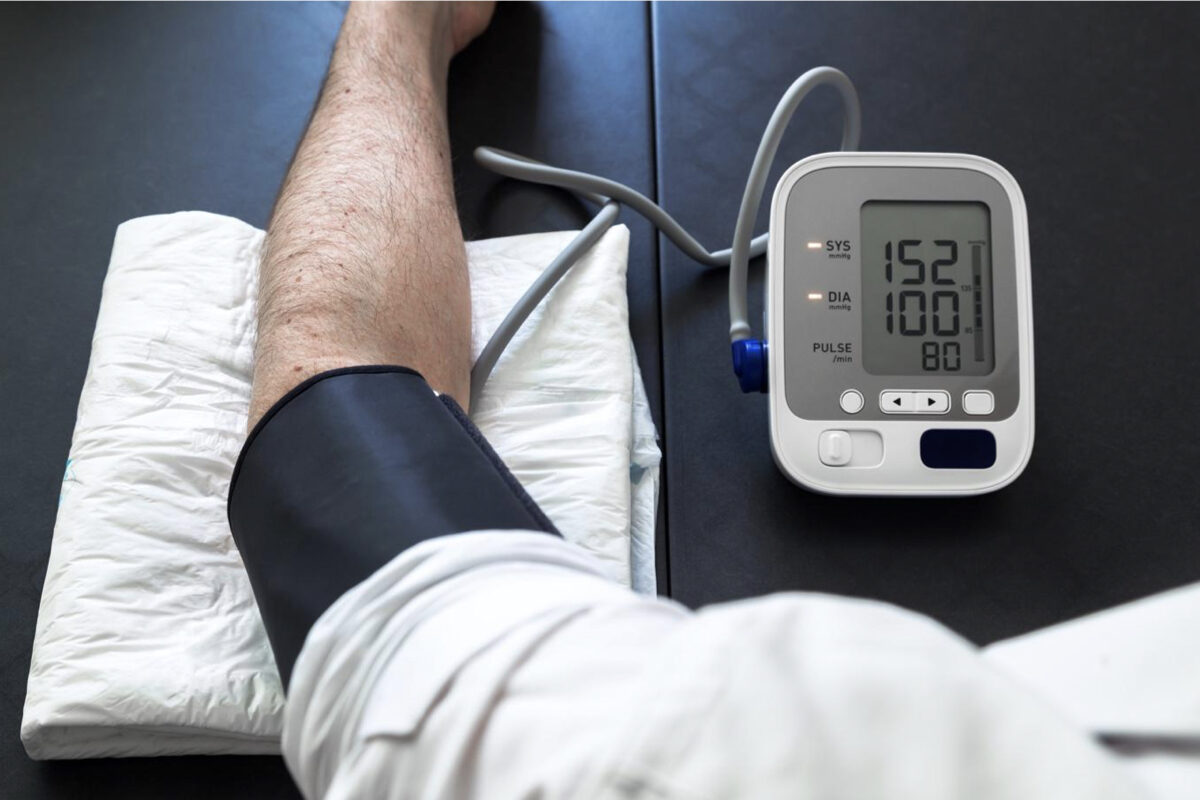 Cao huyết áp ở người trẻ tuổi có thể liên quan đến bệnh thận. (Ảnh: Shutterstock)