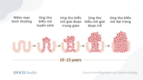 Nội soi đại tràng: Kết quả bất ngờ từ một nghiên cứu lớn, liệu có đáng để thực hiện?