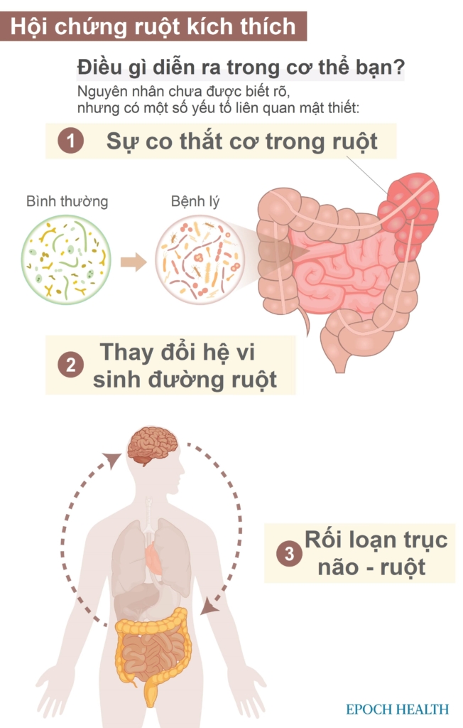 Hội chứng ruột kích thích (IBS): Triệu chứng, Nguyên nhân, phương pháp điều trị và các liệu pháp tự nhiên