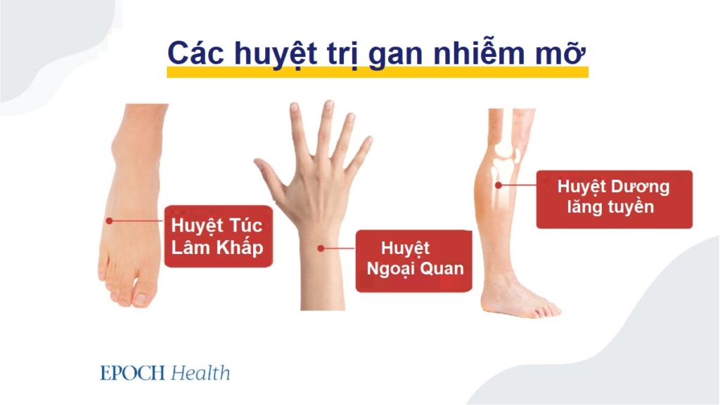 Gan nhiễm mỡ làm tăng nguy cơ ung thư gan–Mẹo phát hiện và phòng ngừa sớm