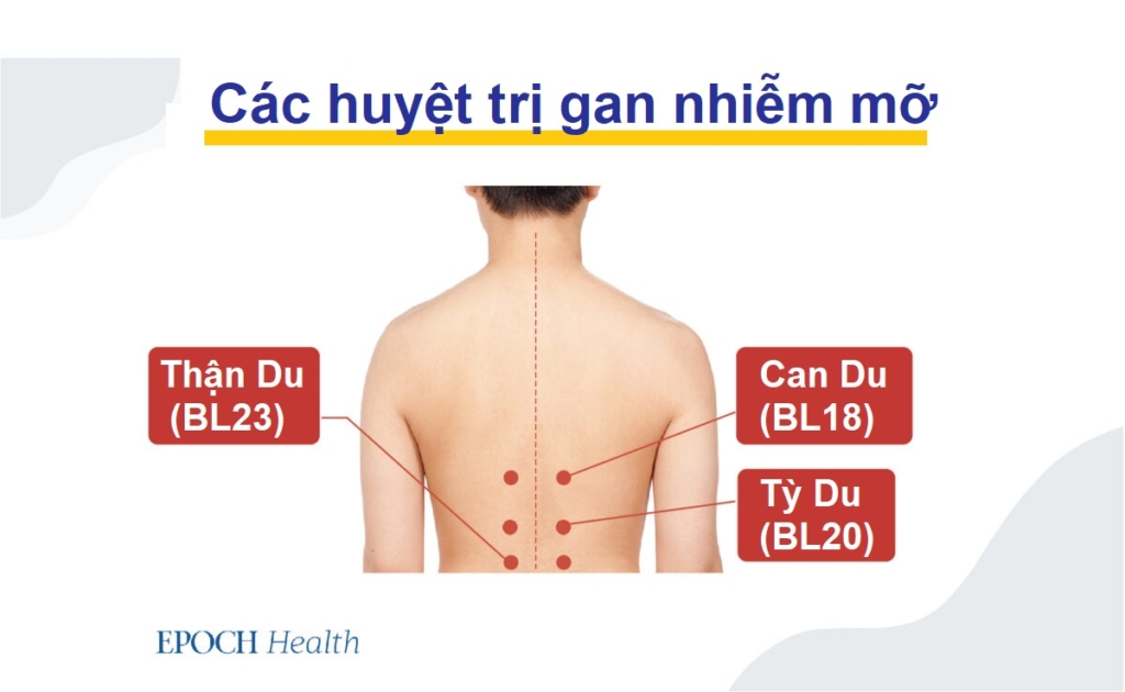 Gan nhiễm mỡ làm tăng nguy cơ ung thư gan–Mẹo phát hiện và phòng ngừa sớm