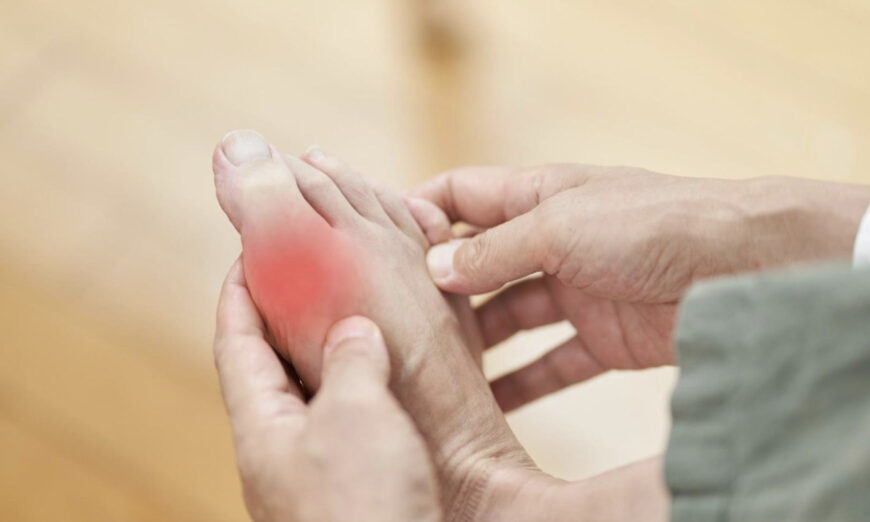 Đừng để bệnh Gout kiểm soát cuộc sống của bạn: Liệu pháp cổ xưa giúp giảm đau nhanh chóng