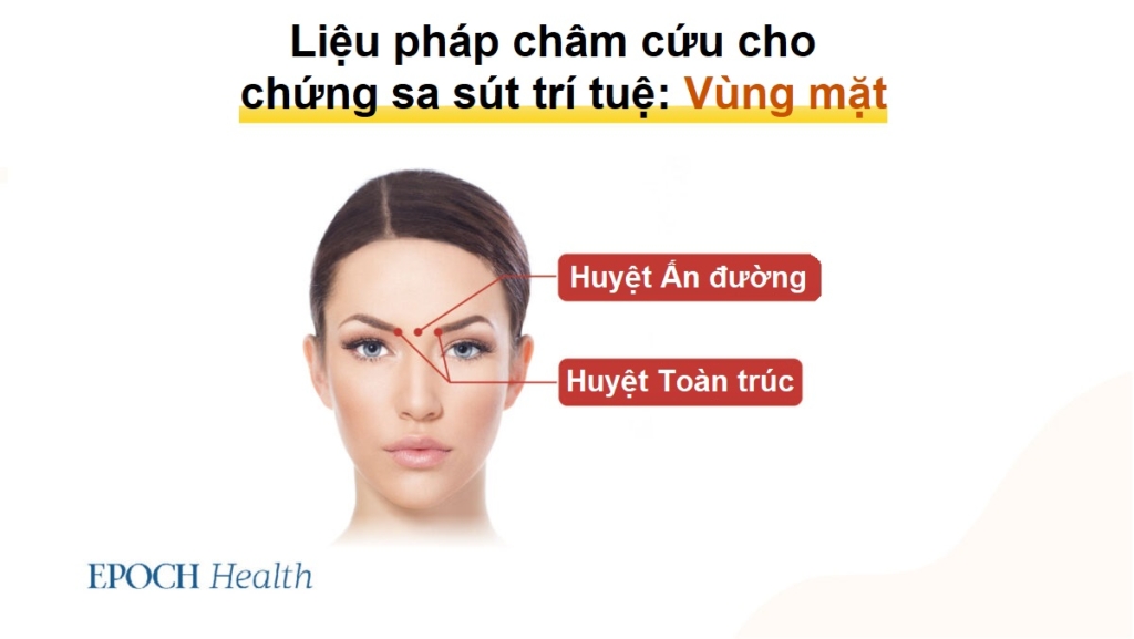 5 môn thể thao dễ gây tổn thương não và các liệu pháp cổ xưa giúp khắc phục chứng sa sút trí tuệ