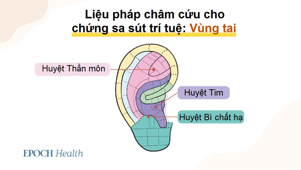 5 môn thể thao dễ gây tổn thương não và các liệu pháp cổ xưa giúp khắc phục chứng sa sút trí tuệ