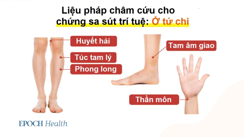 5 môn thể thao dễ gây tổn thương não và các liệu pháp cổ xưa giúp khắc phục chứng sa sút trí tuệ