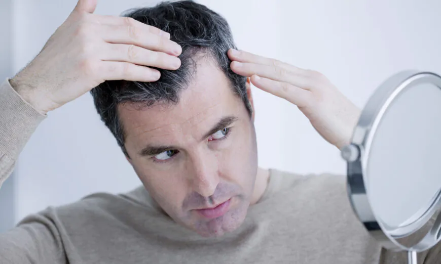 Rụng tóc và tóc bạc sớm: 5 nguyên nhân và cách cải thiện