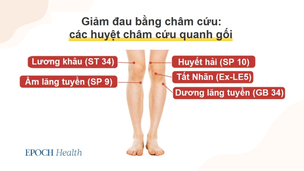 Điều trị thoái hóa khớp bằng liệu pháp cổ truyền không đau, không cần phẫu thuật