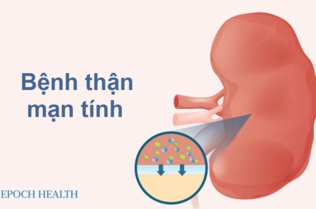 Bệnh thận mạn tính: Triệu chứng, nguyên nhân, phương pháp điều trị và liệu pháp tự nhiên