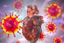 Nghiên cứu mới của Nam Hàn xác định tỷ lệ cao các ca viêm cơ tim trầm trọng (Ảnh: Kateryna Kon/Shutterstock)