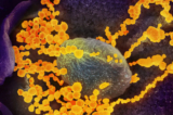 Kính hiển vi điện tử cho thấy hình ảnh về SARS-CoV-2 (vật thể hình tròn màu vàng), virus gây bệnh COVID-19, xuất hiện trong các tế bào nuôi cấy. (Ảnh: NIAID qua The Epoch Times)