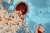 Hình ảnh dưới kính hiển vi của virus HIV1 trên tế bào lympho. Gần đây, các nhà nghiên cứu đã ghi nhận rằng hệ miễn dịch của một số bệnh nhân HIV sản xuất ra các kháng thể để vô hiệu hóa virus HIV. (Ảnh: AFP/Getty Images)
