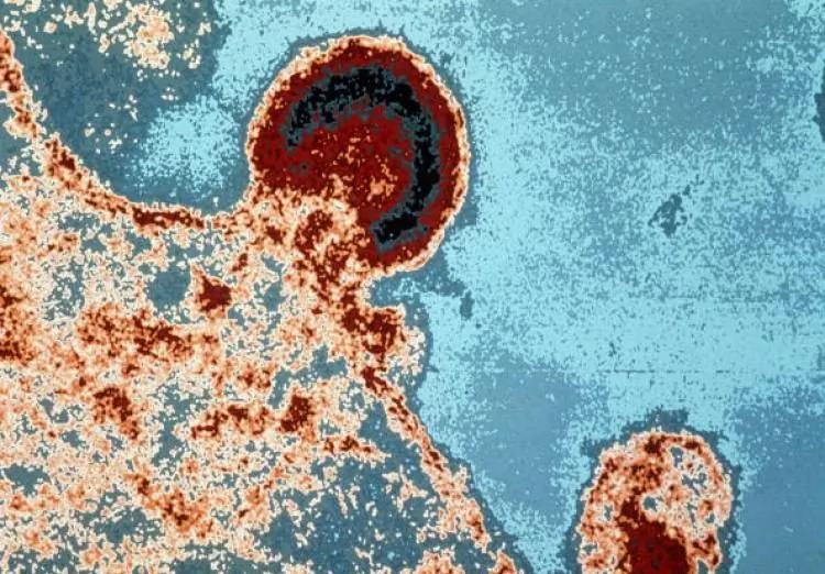 Hình ảnh dưới kính hiển vi của virus HIV1 trên tế bào lympho. Gần đây, các nhà nghiên cứu đã ghi nhận rằng hệ miễn dịch của một số bệnh nhân HIV sản xuất ra các kháng thể để vô hiệu hóa virus HIV. (Ảnh: AFP/Getty Images)
