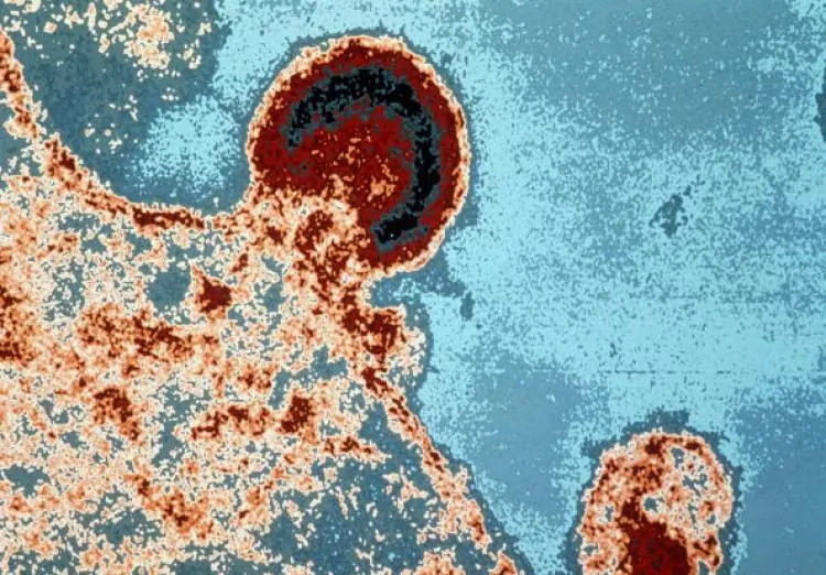 Các trường hợp nhiễm HIV mới liên quan đến thủ thuật lăn kim làm đẹp da mặt