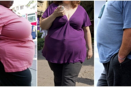 Nghiên cứu: Béo phì làm tăng nguy cơ bị 18 loại ung thư