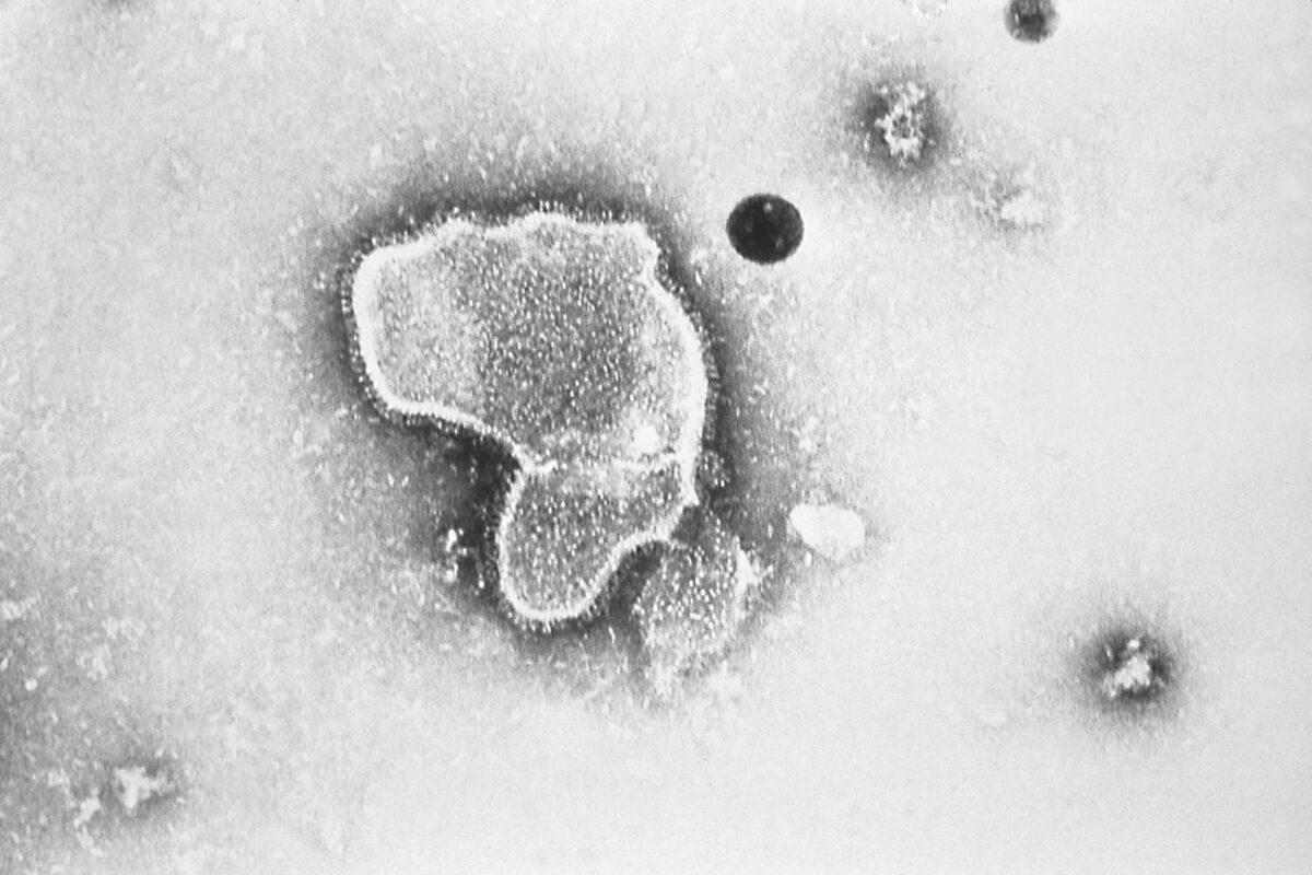 (Một loại virus hợp bào hô hấp ở người, còn được gọi là RSV, được quan sát bởi kính hiển vi điện tử năm 1981. (Ảnh: Trung tâm Kiểm soát và Phòng ngừa Dịch bệnh thông qua AP)