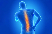Các nguyên nhân gây đau lưng kinh niên  (Ảnh: SciePro/Shutterstock)