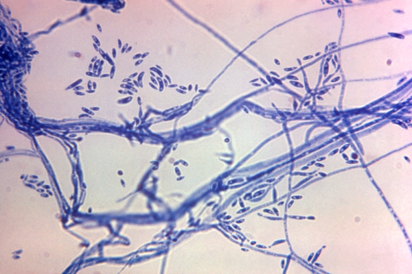 Ảnh chụp bằng kính hiển vi do Trung tâm Kiểm soát và Phòng ngừa Dịch bệnh cung cấp cho thấy Fusarium sp. sinh vật nấm vào năm 1972. Loại nấm này có liên quan đến một dạng viêm màng não hiếm gặp nhưng gây chết người. (Ảnh: Dr. Lucille K. Georg/CDC qua AP)
