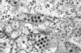 Hình ảnh qua kính hiển vi điện tử truyền qua mô tả một số hạt virus sốt xuất huyết hình tròn được phát hiện trong mẫu mô. (Ảnh: Frederick Murphy/Trung tâm Kiểm soát và Phòng ngừa Dịch bệnh Hoa Kỳ)
