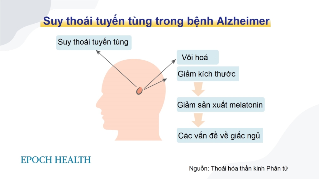 Fluoride trong nước máy có thể làm giảm chỉ số thông minh và làm rối loạn giấc ngủ