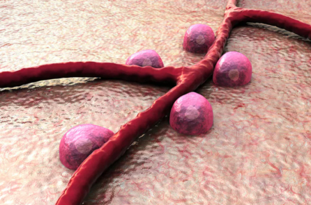 Tỷ lệ bệnh tiểu đường loại 1 ở người trẻ tuổi có liên quan đến COVID-19 đang gia tăng & Cách dự phòng