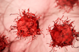 Hình minh họa tế bào ung thư (Ảnh: Kateryna Kon/Shutterstock)