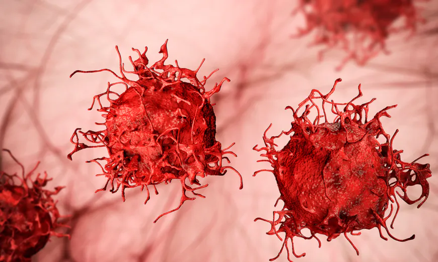 Hình minh họa tế bào ung thư (Ảnh: Kateryna Kon/Shutterstock)