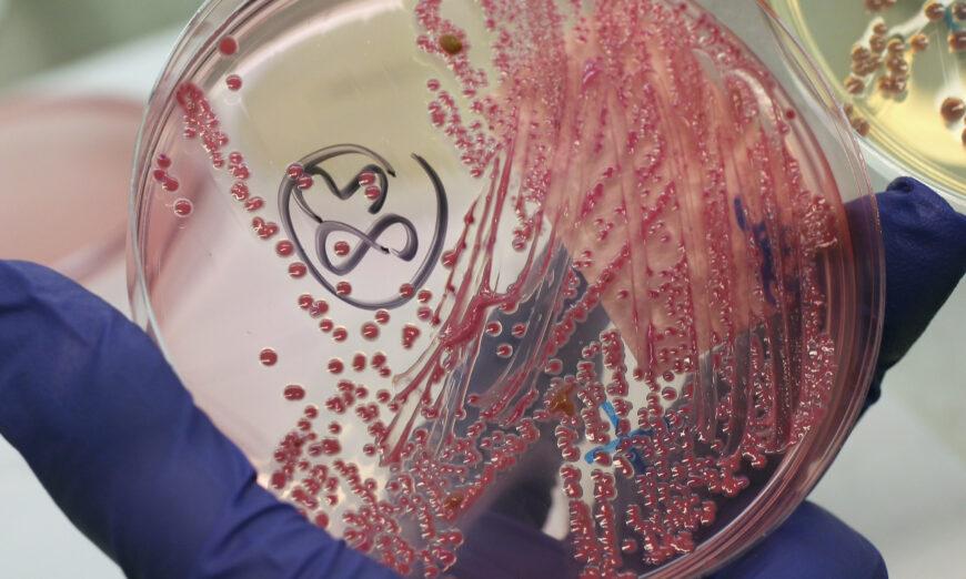 Bức ảnh tư liệu về hoạt động nuôi cấy vi khuẩn cho thấy tình trạng nhiễm trùng dương tính với vi khuẩn E. coli gây xuất huyết đường ruột, còn được gọi là vi khuẩn EHEC vào năm 2011. (Ảnh: Sean Gallup/Getty Images)