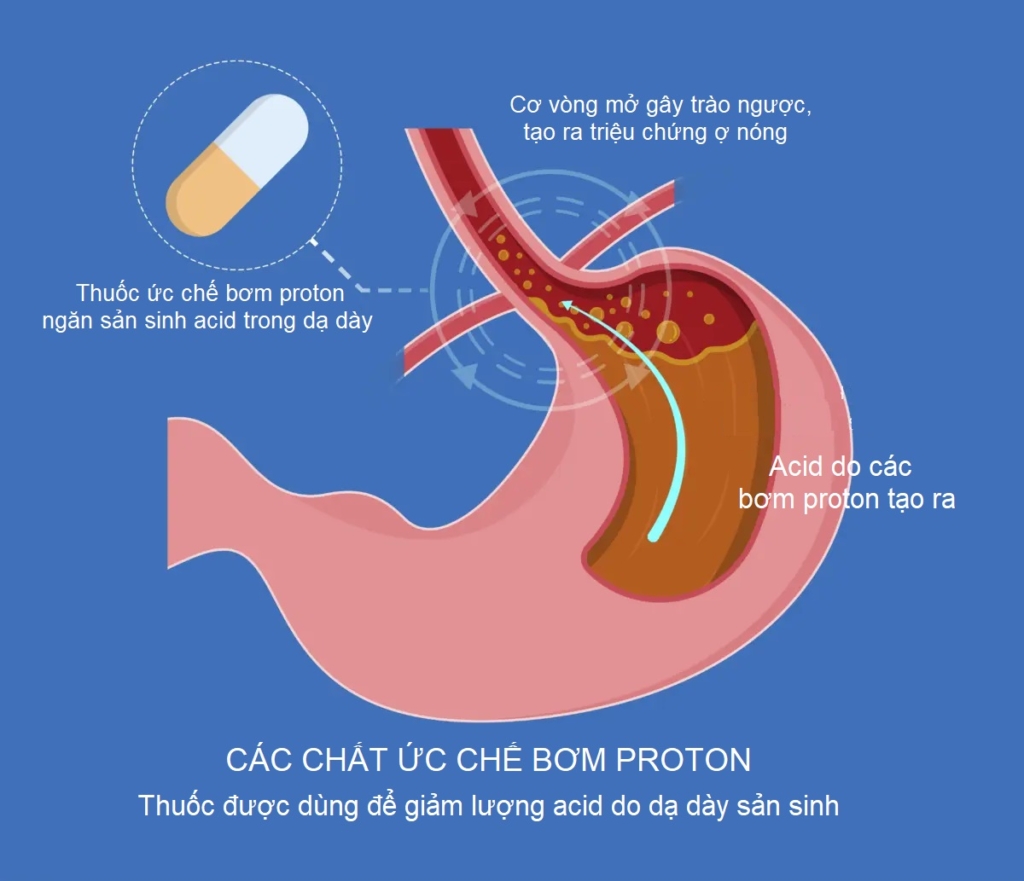 Củ nghệ: Liều thuốc vàng trị chứng khó tiêu hiệu quả