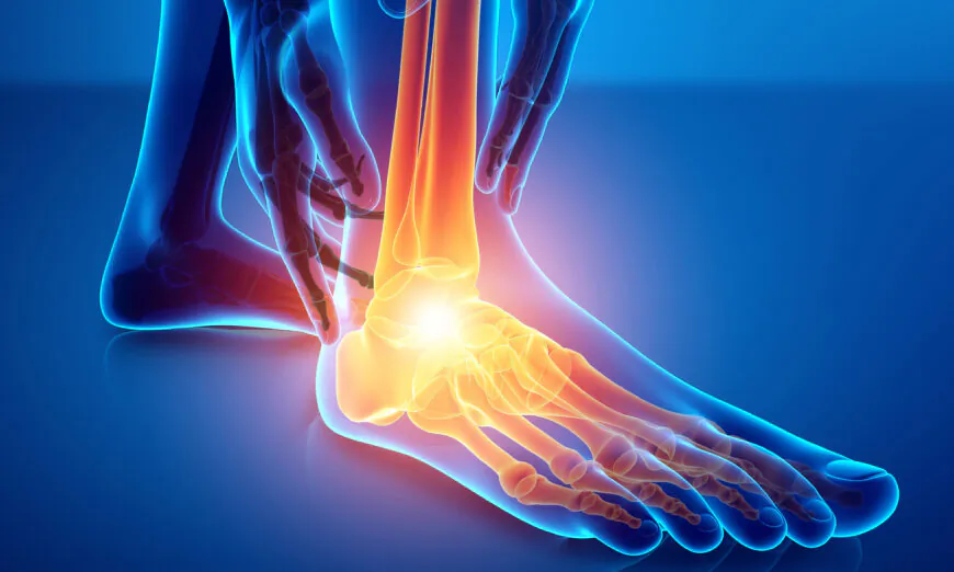 Đau bàn chân kinh niên: 2 nguyên nhân thường gặp và 5 bài tập giảm đau