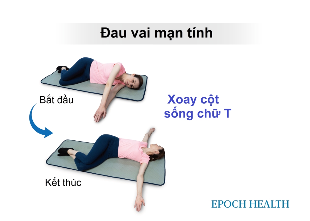 Đau vai kinh niên: Thường do cơ mất cân bằng, 5 bài tập phục hồi vận động, sức mạnh và thăng bằng