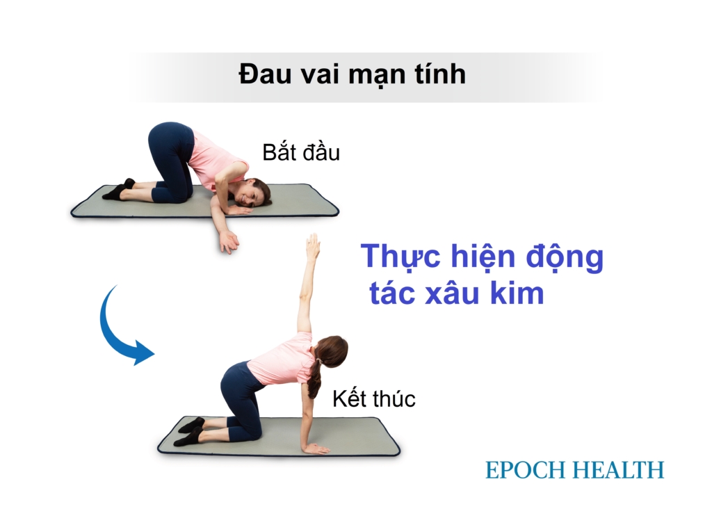 Đau vai kinh niên: Thường do cơ mất cân bằng, 5 bài tập phục hồi vận động, sức mạnh và thăng bằng