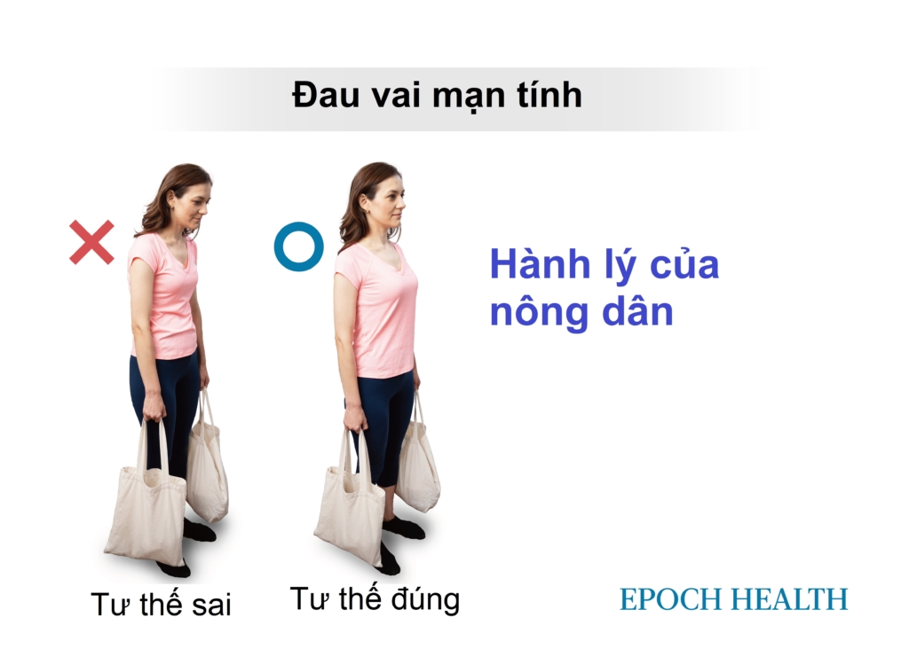 Đau vai kinh niên: Thường do cơ mất cân bằng, 5 bài tập phục hồi vận động, sức mạnh và thăng bằng