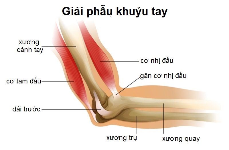 Đau khuỷu tay kinh niên: Thường do yếu cơ, 6 bài tập đơn giản giúp giảm đau