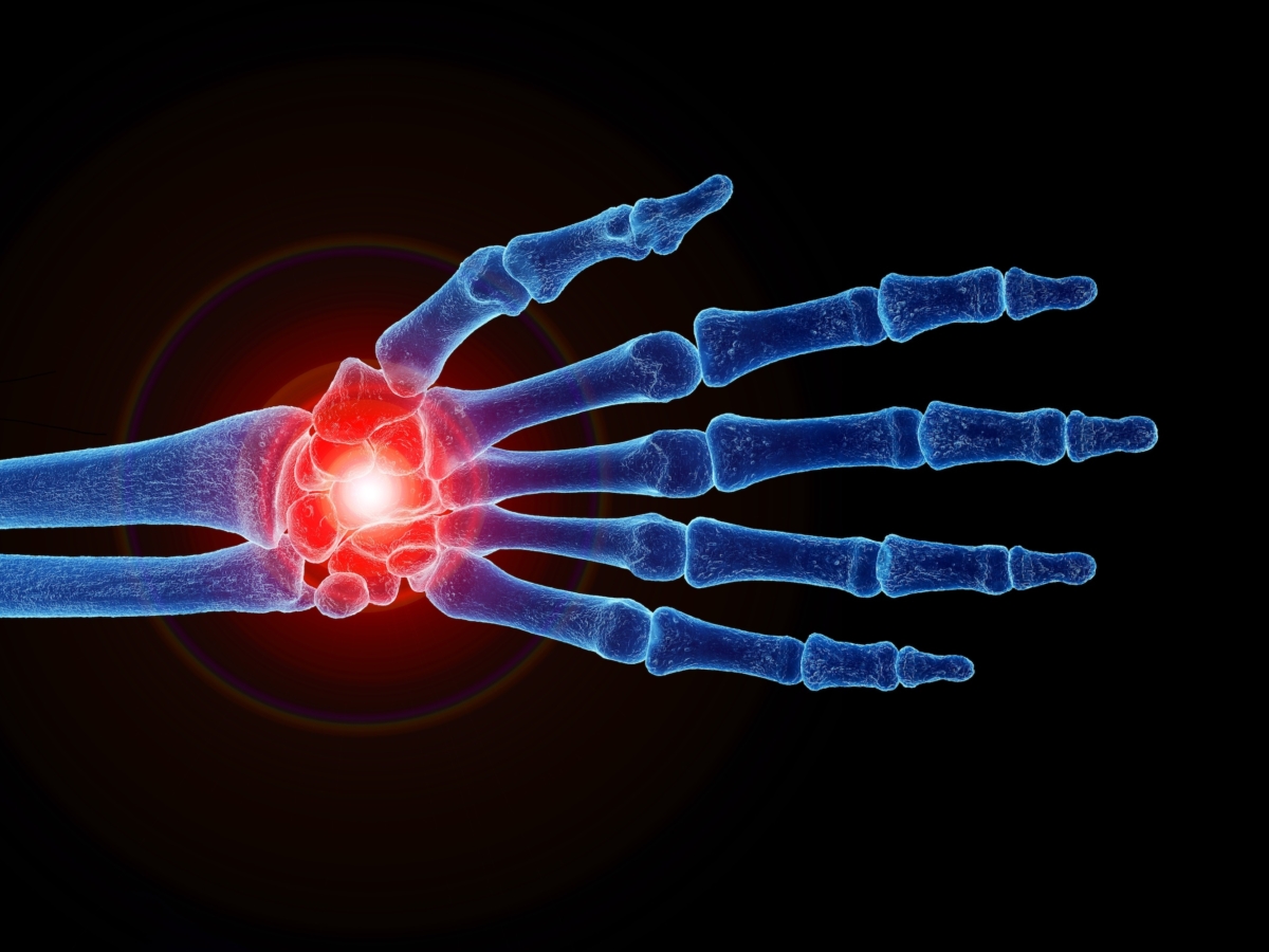 Đau cổ tay kinh niên: Có thể kéo dài trong nhiều năm, các bài tập giảm đau hàng đầu của bác sĩ trị liệu