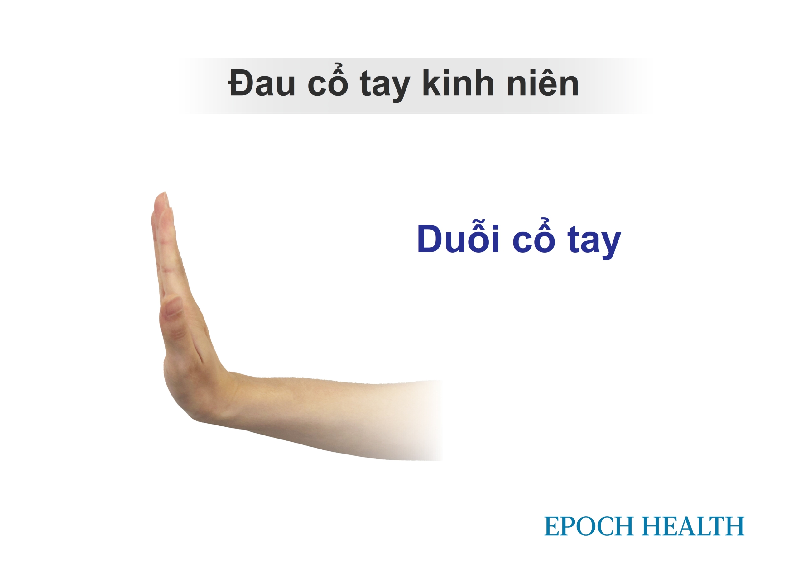 Đau cổ tay kinh niên: Có thể kéo dài trong nhiều năm, các bài tập giảm đau hàng đầu của bác sĩ trị liệu