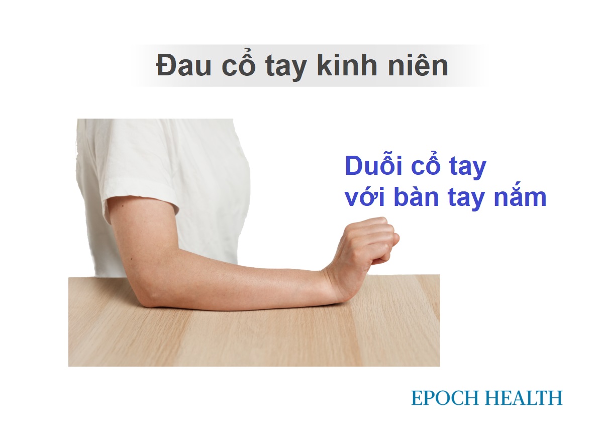 Đau cổ tay kinh niên: Có thể kéo dài trong nhiều năm, các bài tập giảm đau hàng đầu của bác sĩ trị liệu