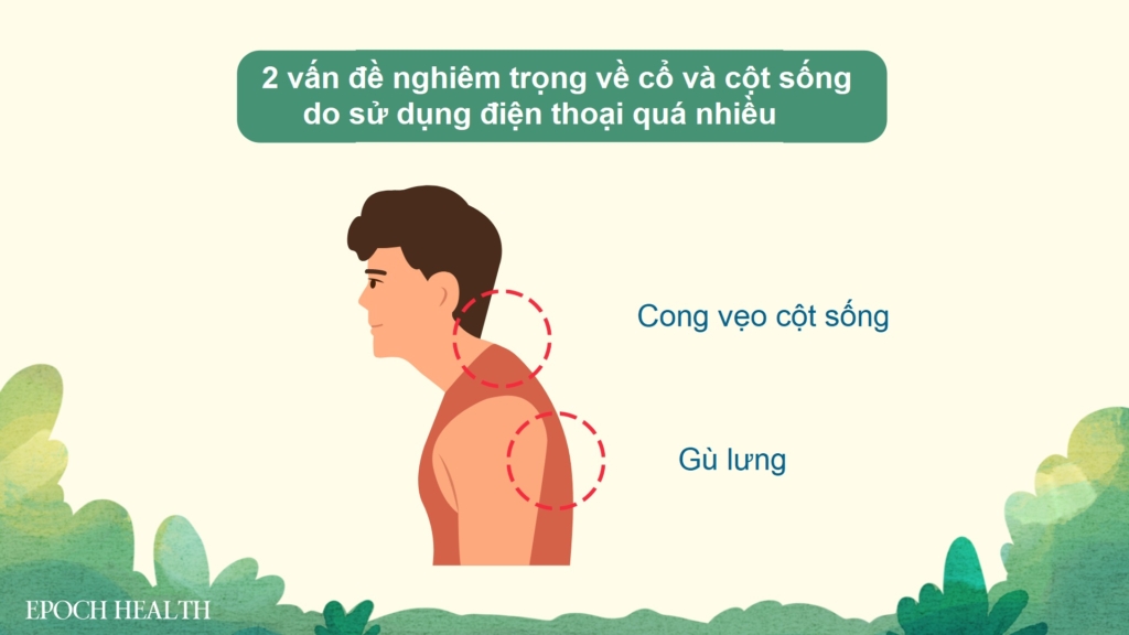 8 bài tập ngăn ngừa gù lưng và hại mắt do dùng điện thoại