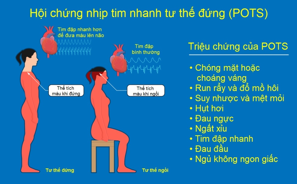 Chân xanh: Một triệu chứng mới của COVID kéo dài