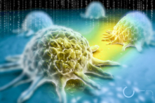 Tế bào ung thư (Ảnh: Creations/Shutterstock)