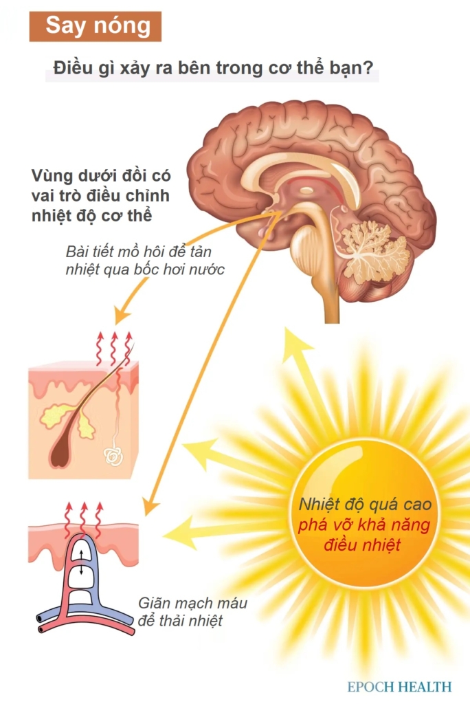 Hướng dẫn cơ bản về say nóng: Triệu chứng, nguyên nhân, phương pháp điều trị và phòng ngừa